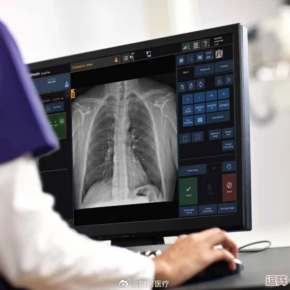 胸片全体曝光:揭示医疗影像背后的隐私问题与伦理挑战,呼吁加强对患者信息的保护和管理 胸片全体曝光:揭示医疗影像背后的隐私问题与伦理挑战,呼吁加强对患者信息的保护和管理
